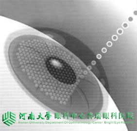 近視度數(shù)不同，手術(shù)方式怎么選